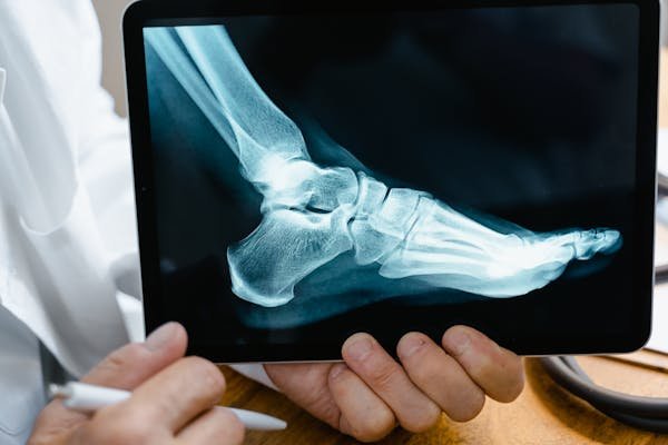 Découvrez les meilleures solutions orthopédiques sur podoways